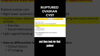 Distinguishing Ruptured Ovarian Cyst from Acute Appendicitis  MCCQE1 [upl. by Nolyk468]