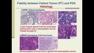 PatientDerived Xenografts for Cancer Therapeutics Development and Predictive Modeling [upl. by Arondel]