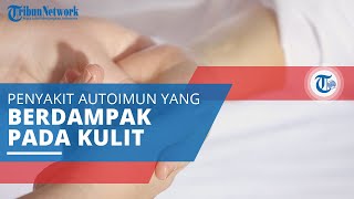 Dermatitis Herpetiformis Penyakit Autoimun yang Berdampak pada Kulit karena Bereaksi dengan Gluten [upl. by Lesley]