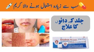 Betaderm N Cream uses in Urdu  Acne Cream Review [upl. by Annail]