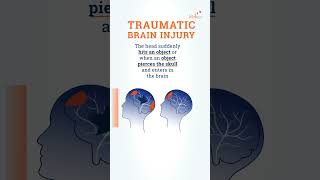 What is a traumatic brain injury [upl. by Teresina]