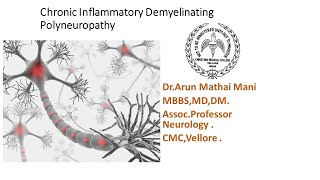 Chronic Inflammatory Demyelinating Polyneuropathy CIDP  DrArun Mathai CMC Vellore [upl. by Bernita]