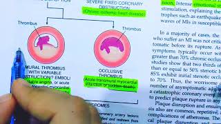 Ischemic heart diseasePathology of Ischemic heart diseaseAcute plaque changesRobbins pathology [upl. by George60]