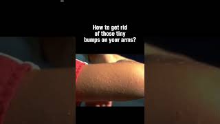 How to treat those tiny bumps on your arms skincare skincareadvice bodycare skincareroutine [upl. by Helbonnas]