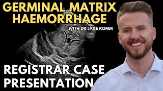 Germinal Matrix Haemorrhage  Cranial Ultrasound  Registrar Sessions [upl. by Elora]