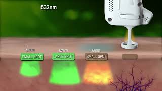 Lutronic DermaV 醫學級血管激光  治療原理及儀器簡介 [upl. by Siravrat]