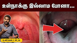 நமக்கு உள்நாக்கு இருக்குறது இதுக்காகத் தான்🙄  Uvula problems explained  Uyirmei Ep36 [upl. by Melisande]