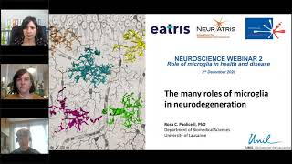 Neuroscience Webinar  Role of microglia in health and disease [upl. by Erreid]