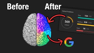 My Brain after 569 Leetcode Problems [upl. by Garret778]