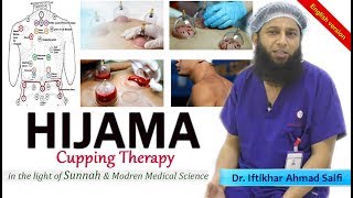 English What is Hijamah  Cupping Therapy in the light of Sunnah ampMedical Science DrIftkhar Saifi [upl. by Orth218]