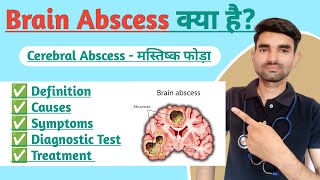 Brain Abscess Lecture in Hindi  Causes Symptoms And Treatment of Brain Abscess [upl. by Diannne4]