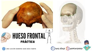 Anatomía Hueso frontal  Generalidades caras bordes accidentes  Práctica [upl. by Hoang888]