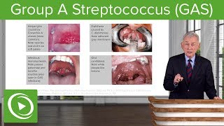 Group A Streptococcus GAS – Infectious Diseases  Lecturio [upl. by Astrid711]