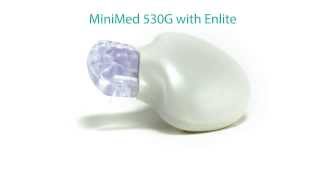 Introducing the Enlite CGM Sensor for use with the MiniMed 530G system [upl. by Pournaras]