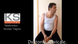 Dystonie cervicale torticolis rotatoire gauche [upl. by Nyrb554]