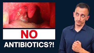 Antibiotics for Strep Throat Do We Need Them [upl. by Brebner]