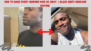 How to make every Ingrown hair go away  Black Men’s Skincare Routine  2021 [upl. by Antoinetta775]