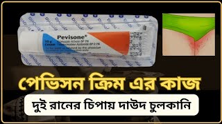 pevisone cream এর কাজ কি কি ভাবে ব্যাবহার করতে হয় দাউদ ও চুলকানি ওষুধ [upl. by Bechler536]