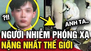 Chàng trai người Nhật NHIỄM PHÓNG XẠ nặng nhất thế giới và 83 ngày ĐỊA NGỤC  Tin 3 Phút [upl. by Aibsel592]