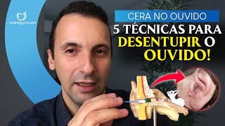 Como Desentupir o Ouvido e Quanta Cera Retirar 5 Técnicas diferentes e como deve limpar em casa [upl. by Aikmat]