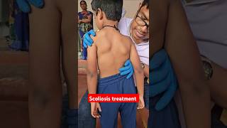 Scoliosis treatment drrajneeshkant worldfamouschiropractor [upl. by Ecilahs]