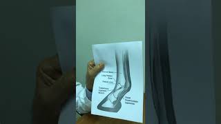 مفصل المعقم في الخيل affection of fetlock joint in horse [upl. by Ayaj]