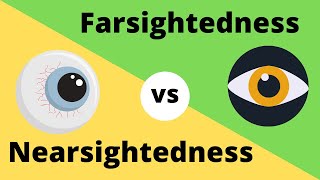 Difference between Myopia  Near Sightedness and Hyperopia  FarSightedness [upl. by Repooc]