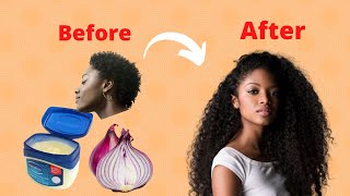 How to use Vaseline and onion to grow hair 2 cm per day Very fast [upl. by Dauf]