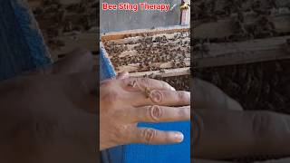 Bee Sting 🐝 shorts bees beekeeping [upl. by Ameer646]