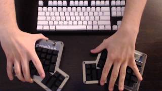 ErgoDox Opensource Split Fully Programmable Ergonomic Mechanical Keyboard Review [upl. by Welch]