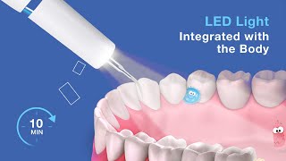 Luelli Ultrasonic Dental Calculus Remover [upl. by Neeluqcaj]