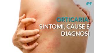 Orticaria sintomi cause e diagnosi [upl. by Enert]