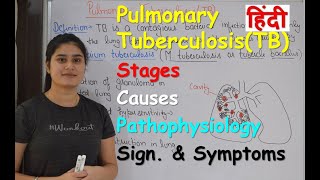 Pulmonary Tuberculosis in Hindi  Stages  Causes  Pathophysiology  Sign amp Symptoms [upl. by Line298]