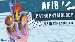 AFIB Atrial Fibrillation Pathophysiology Cardiac Nursing [upl. by Elleinnad354]