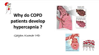 Why does COPD cause hypercapnia [upl. by Enelrahc]