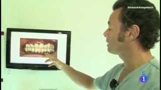 Reportaje  Precio y calidad de implantes dentales  Comando actualidad [upl. by Eatnod]