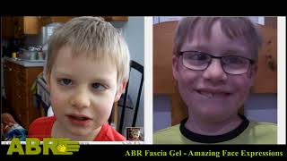 ABR Fascia Gel  Amazing Face Expressions Video 2 of 3 [upl. by Lauren]