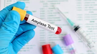 Serum Amylase Test Procedures [upl. by Kramer]