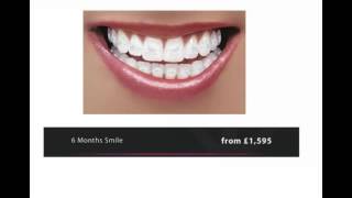 How Much Do Braces Cost in London [upl. by Norford]