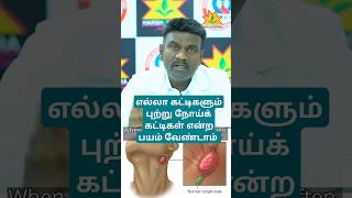 புற்றுநோய் கட்டிகள்  DrGGovindarajSurgical oncologist doctor earlydetection earlyscreening [upl. by Kurtis]