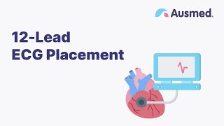 12Lead ECG Placement  Ausmed Explains [upl. by Anicart]