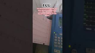 📈ecg heart beats cardiac function signal ytshorts video short [upl. by Marchelle]