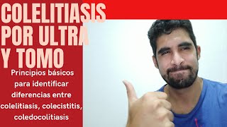 Colelitiasis y colecistitis diferencias clínicas y por ultrasonido [upl. by Dela535]