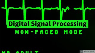 DSP  L8  Solving 8 point DFT of a time domain sequence with its magnitude and phase angle [upl. by Omidyar]