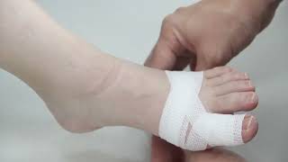 Toe Bandaging Principles and Tips [upl. by Urbai]