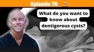 Ep 76  What do you want to know about dentigerous cysts [upl. by Anah]