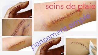 Soins infirmiers en chirurgie soins des plaies  pansement simple [upl. by Arata]