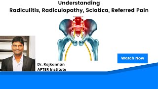 Radiculitis Radiculopathy Sciatica amp Referred Pain  Explained [upl. by Biron]