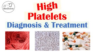 What is Thrombocytosis Diagnosis amp Treatment of High Platelets  Rapid Review [upl. by Gibbon964]