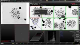 DCScore  Automated Scoring of Dicentric Chromosomes [upl. by Kutchins]